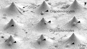 This extreme close-up with a scanning electron microscope shows oligodendrocytes cultured in a well among the tapered glass micropillars. Reprinted by permission from Macmillan Publishers Ltd.: <em>Nat. Med.</em>, 2014 July 6 (doi 10.1038/nm.3618, copyright 2014)].