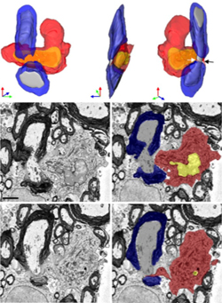 These scanning electron microscope images and three-dimensional reconstructions show a monocyte (red cytosol, yellow nucleus) next to a node of Ranvier from a mouse spinal cord, with two of the cell’s microvilli (black and white arrows) between the myelin (blue) and axon (gray). ©Yamasaki <em>et al</em>., 2014, Originally published in <em>J. Exp. Med</em>. doi: 10.1084/jem.20132477.