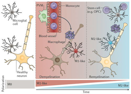 <strong>Shades of microglia.</strong> In the brain and spinal cord, microglia continuously survey their microenvironment, a recently identified behavior that several researchers are calling M0. Neuronal dysfunction or damage can activate microglia to produce pro-inflammatory cytokines, called M1. Meanwhile, macrophages lurking on the edge of the brain and in the blood may join the inflammatory response. Over time, depending on the type of brain injury or environmental factors, microglia and their monocyte/macrophage cousins may acquire an anti-inflammatory phenotype, known as M2, which causes them to remove debris and promote regeneration. The activation states of microglia and macrophages can mix and switch. Reprinted by permission from Macmillan Publishers Ltd.: <em>Nat. Rev. Neurosci.</em> 2014 May;15(5):300-12. doi: 10.1038/nrn3722, copyright 2014.