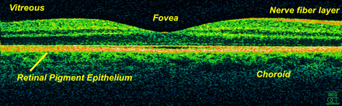 Optical coherence tomography of a normal retina at 800 nm and an axial resolution of 3 micrometers.