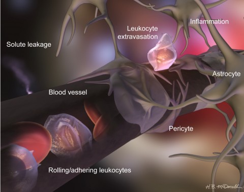 Fig. 1. The BBB. The defenses of the endothelial cells that make up the walls of blood vessels are fortified by pericytes, which closely wrap around the endothelial cells, and astrocytes, star-shaped brain cells that send out projections that enclose much of the blood vessel perimeter. In inflammatory disease states, leukocytes rolling along the vascular wall stick to endothelial cells and then cross through the wall (extravasate) and into the brain tissue. As the BBB undergoes further damage, solutes can leak through the previously tight barrier.