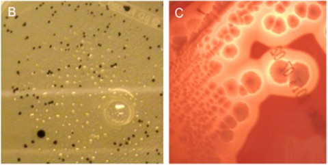 On the left, typical black <em>C. perfringens</em> morphology from a diluted fecal sample of a patient with clinically isolated syndrome. On the right, typical <em>C. perfringens</em> morphology on Schaedler blood agar plates (Rumah <em>et al</em>., 2013).