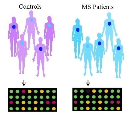 Fig. 2. Genome-wide association studies (GWAS) and MS. GWAS scan hundreds of thousands of points along the genome and identify single-nucleotide differences between MS cases and controls. In this image, one variant of a gene (represented by the light blue dot) is more prevalent among control subjects, whereas another variant of the same gene (represented by the dark blue dot) is more prevalent  among people who have MS. The microarrays at the bottom of the image register a strong signal for the control variant among the control subjects but a weak signal among the individuals with MS (arrows).  