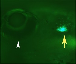 T cells labeled with green fluorescent protein (yellow arrow) light up in the thymus gland of this zebrafish larva, providing an assay for compounds active against the T cells. The white caret points to the larva’s eye. Credit: Nikolaus Trede.