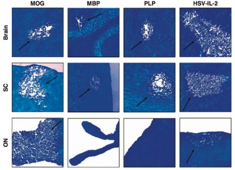 Investigators injected mice with myelin oligodendrocyte glycoprotein, myelin basic protein, or proteolipid protein or infected them ocularly with HSV-IL-2. After 29 days, investigators removed brains, spinal cords, and optic nerves and stained sections for Luxol fast blue. Arrows indicate areas of demyelination. Reprinted by permission from Macmillan Publishers Ltd: Gene Therapy (Dumitrascu <em>et al</em>.), copyright 2014.