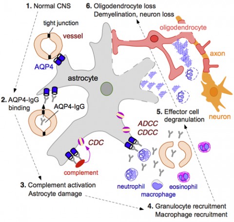 Model of the effects of the aquaporin-4 antibody in NMO patients: Once the aquaporin-4 antibody enters the CNS, it binds to the water channels on the astrocytes (1; 2). The antibody coat activates the complement system, which results in the formation of a membrane attack complex that punches holes in the astrocytes, a process called complement-dependent cytotoxicity, or CDC (3). The antibody coat also leads to the recruitment of immune cells that further damage the astrocyte, a process called antibody-dependent cellular cytotoxicity, or ADCC (4; 5). Once the astrocytes die, oligodendrocytes and nerve cells die as well, and without the oligodendrocytes, the myelin sheath around the nerve fibers disappears (6). Credit: Alan Verkman, University of California, San Francisco