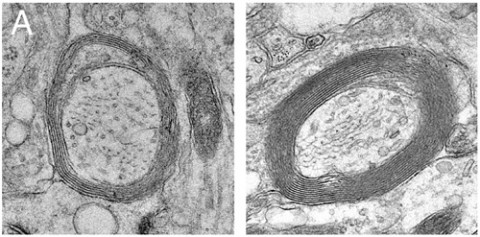 Electron micrographs depict increased myelin in slice cultures following treatment with IFNγ-stimulated exosomes (right) compared to untreated control (left). From Pusic <em>et al</em>., 2014.