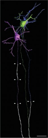 High-resolution renderings of three representative neurons showing three myelination modes. Myelin is white, and arrowheads mark boundaries. Scale bar: 20 μm. Credit: Tomassy <em>et al</em>., <em>Science</em> 2014.