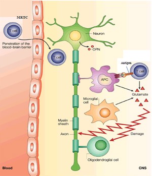 In MS, myelin-reactive T cells (MRTC) traverse the blood-brain barrier from the periphery. In the brain, antigen-presenting cells (APCs) activate the T cells to release cytokines that set into motion the destruction of myelin. Credit: Adapted by permission from Macmillan Publishers Ltd: Nature Reviews Immunology 3:483-492, copyright 2003.