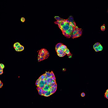 Las colonias de células IPSC ratón verde-etiquetadas también tienen una mancha roja que indica la presencia de SSEA, un marcador de células madre embrionarias.  Estas células pueden ser inducidas a crecer en neuronas, astrocitos, o células precursoras de oligodendrocitos.  Los núcleos celulares se tiñen de azul.  Crédito: Cecilia Laterza