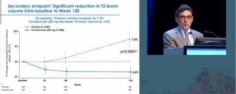 Xavier Montalbano presents the ORATORIO results of ocrelizumab in primary progressive MS compared to a placebo. Official presentation of ECTRIMS 2015. Courtesy of Roche/Genentech.