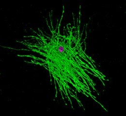 Myelin marvel: This image from a mouse brain (cortex) shows a single oligodendrocyte (purple) extending its myelin (green) to wrap short stretches, or internodes, of about 75 nearby axons. In demyelinating diseases such as multiple sclerosis, the immune system attacks the myelin, leaving the axons vulnerable to damage and degeneration. The clemastine trial showed modest evidence of myelin repair in the visual system. Courtesy of Jonah Chan lab.