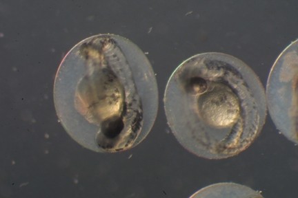 Fig. 2 Zebrafish embryos. Some researchers are using zebrafish embryos (pictured here at 3 days old) to screen for drugs that might spur myelination. These organisms are inexpensive, fast-breeding, and see-through--features that allow researchers to easily examine how particular genes drive myelination and to observe the effects of various compounds on the process.  