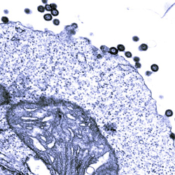 In one possible scenario, an environmental factor activates endogenous retrovirus particles in people with MS. These particles bud out, infecting other cells and inflaming the immune system. Here, proteins from an artificially resurrected retrovirus in the HERV-K family are released from human cells in a laboratory experiment. From: Lee YN and Bieniasz PD (2007), <em>PLOS Pathogens</em> DOI: 10.1371/journal.ppat.0030010]