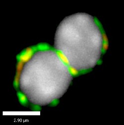 A B cell is dominated by its nucleus (light gray), making it difficult to track signaling molecules from the surface into the cytoplasm (green, yellow, and orange). Credit: Courtesy of Mridu Acharya and Anna Sokolovska