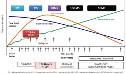 Progression in MS. Courtesy Dr. Gavin Giovannoni