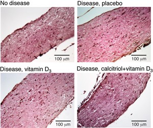 One calcitriol dose plus supplementary vitamin D<sub>3</sub> reversed the disease-induced swelling of the optic nerve. © C. E. Hayes, U. Wisconsin