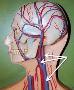 Left internal jugular vein.