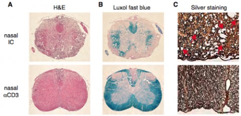 Nasal anti-CD3 compared to isotype control antibody halts neurodegeneration. Spinal cord sections demonstrate (A) mononuclear infiltration and vacuoles indicating edema, (B) demyelination, (C) axonal injury with spheroids (red arrows). Image courtesy Lior Mayo.