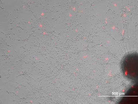 A cultured cluster of neural stem cells (derived from iPSCs) differentiating into neural cell types, with immature oligodendrocytes labeled with a red fluorescent marker.