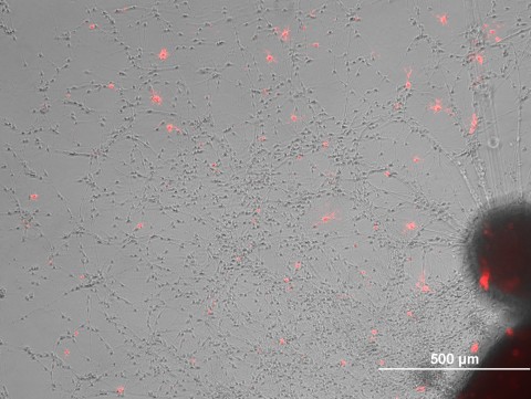 A cultured cluster of neural stem cells (derived from iPSCs) differentiating into neural cell types, with immature oligodendrocytes labeled with a red fluorescent marker.