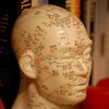 head acupuncture